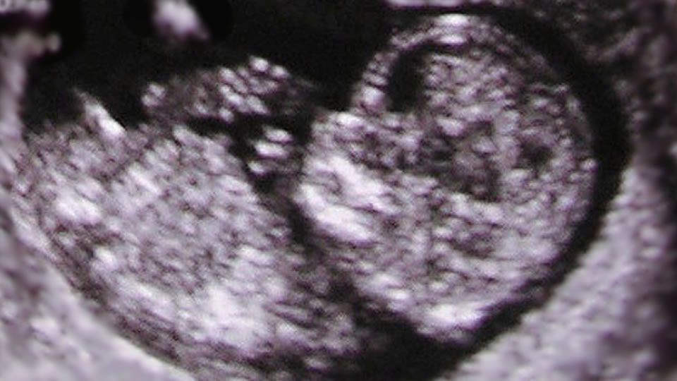 2017-01-12-Ky-PCUCPA